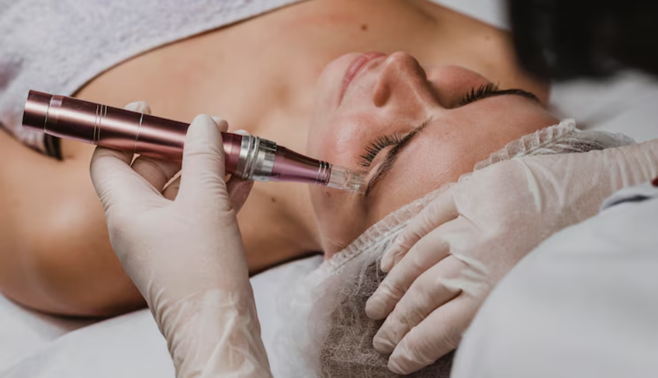 Benefits of Candela PicoWay Laser