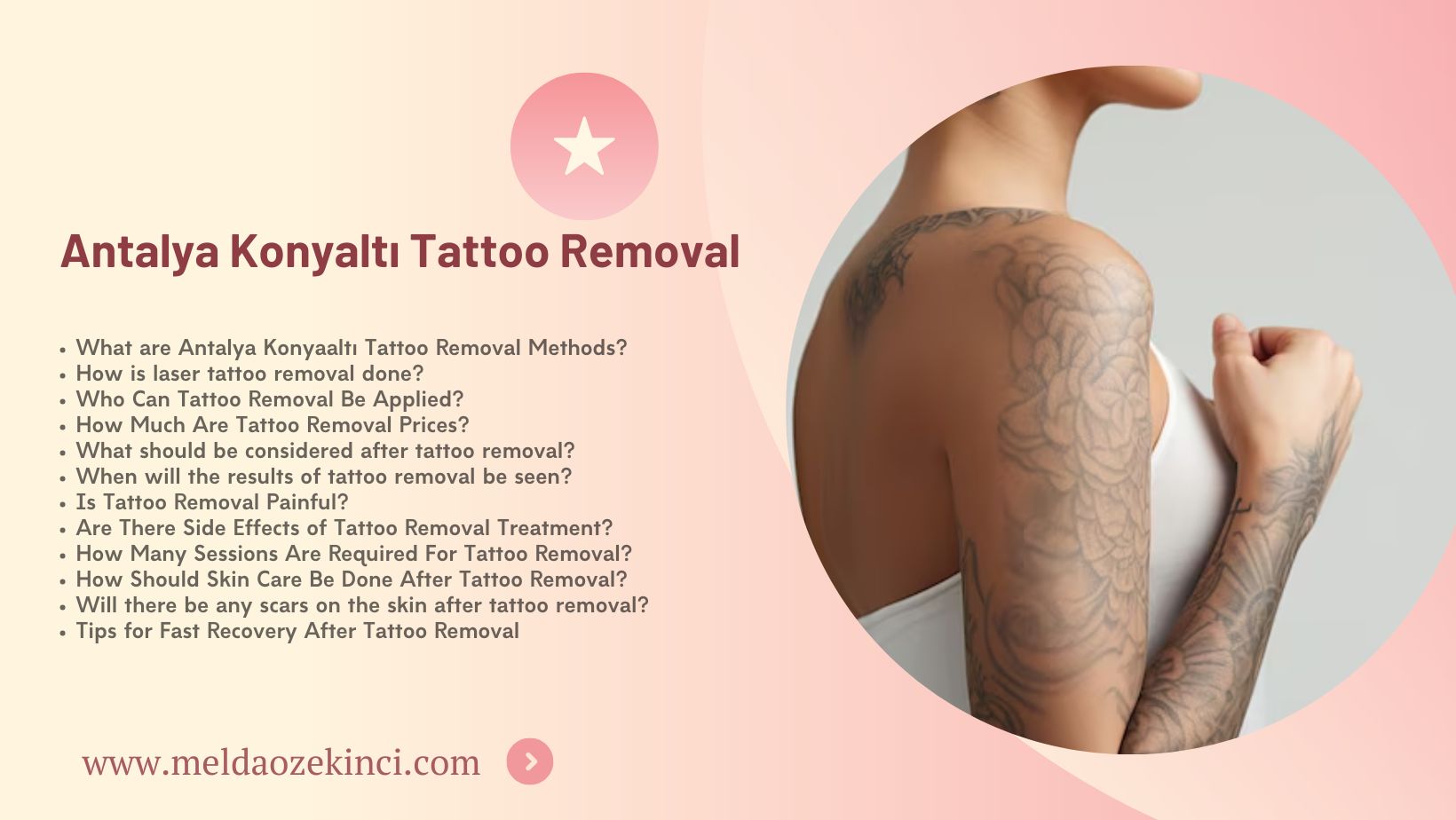 Antalya Konyaltı Tattoo Removal