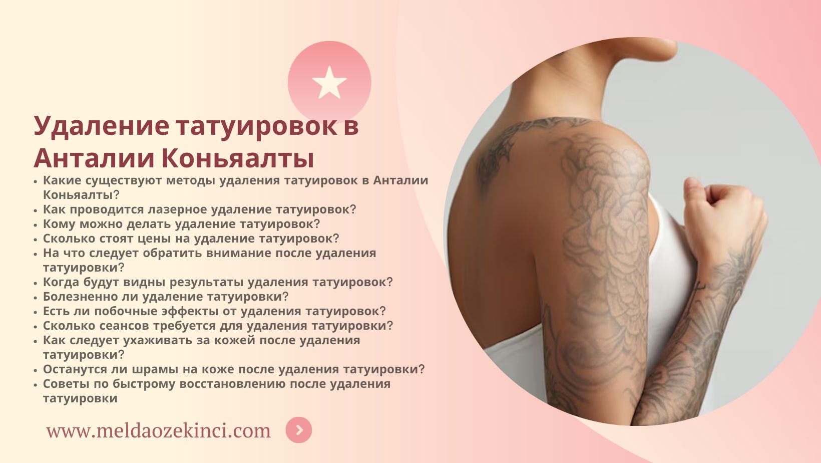 Анталия Коньялты Удаление татуировок