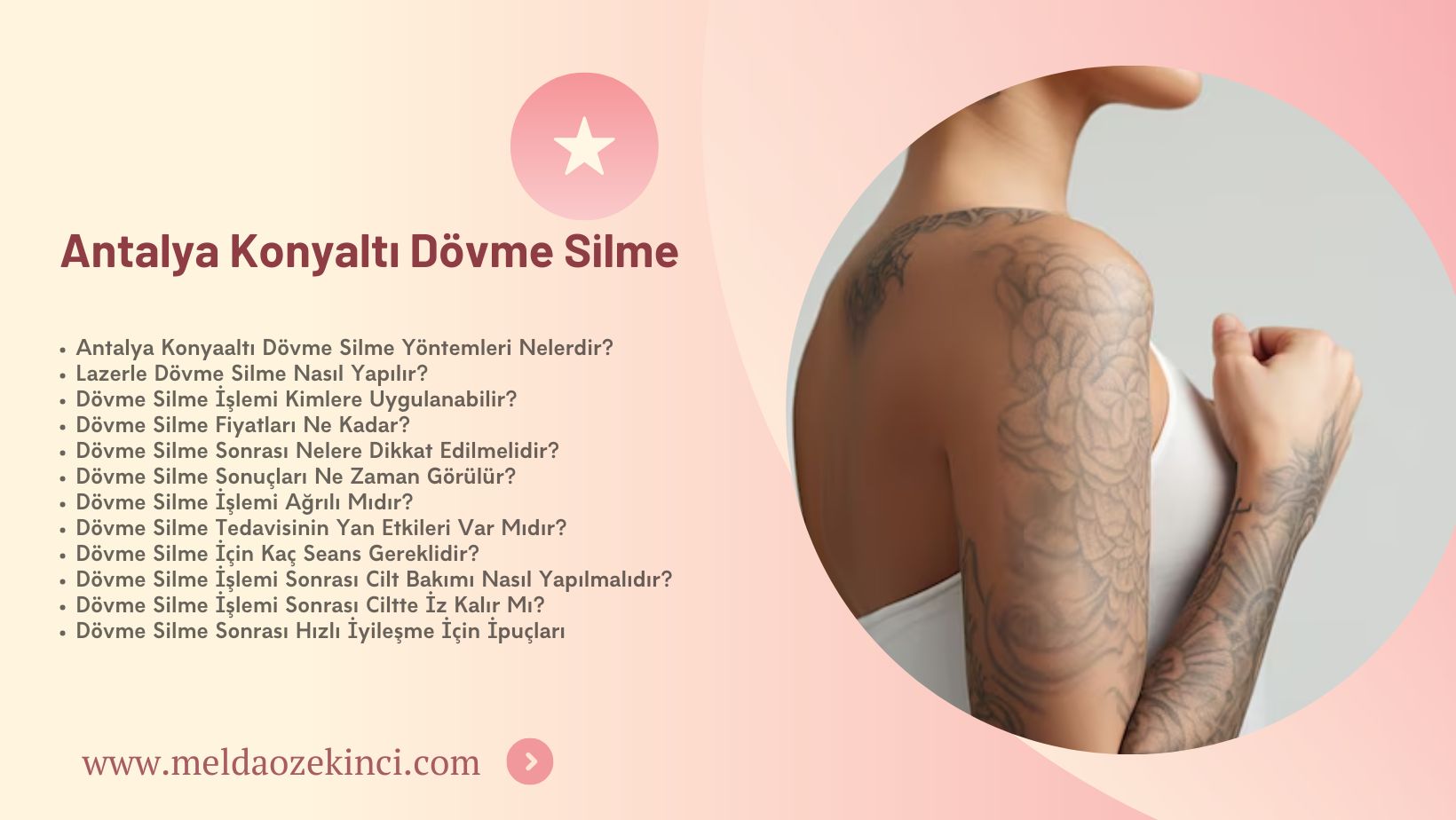 Antalya Konyaltı Dövme Silme