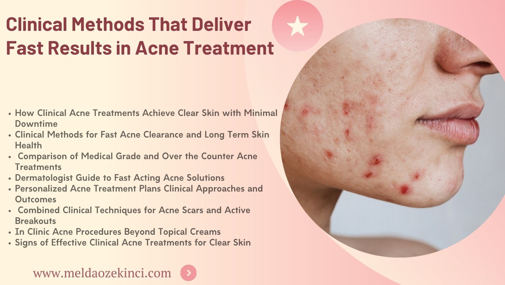 Clinical Methods That Provide Fast Results in Acne Treatment