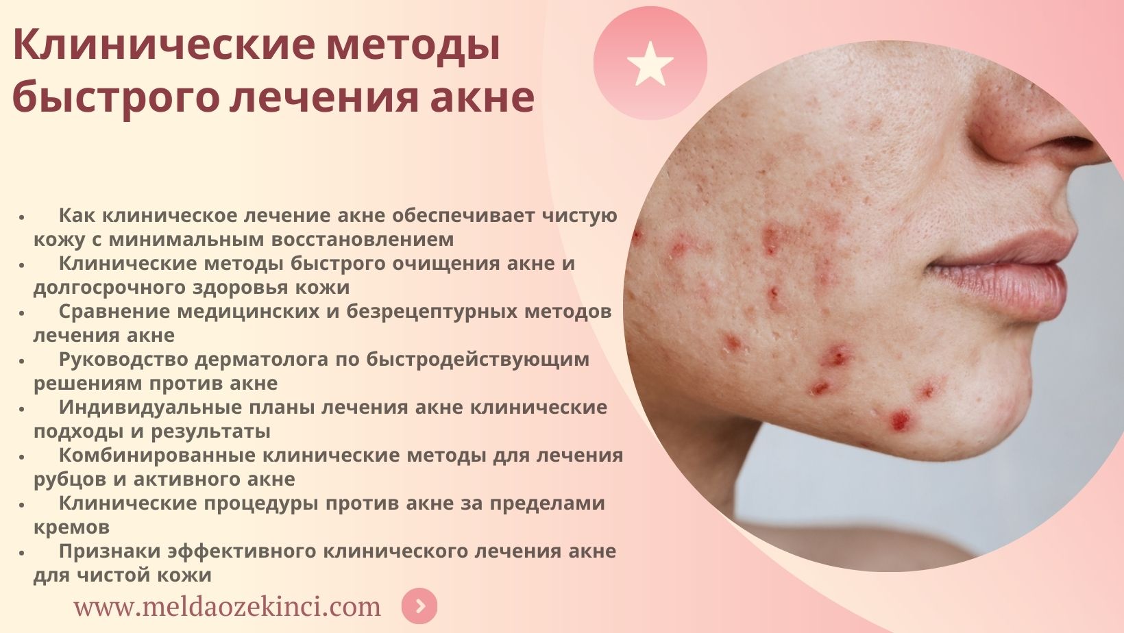 Клинические методы, обеспечивающие быстрые результаты в лечении акне