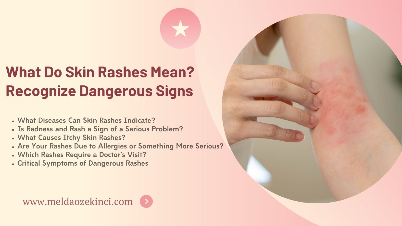 What Do Skin Rashes Mean? Recognize Dangerous Signs