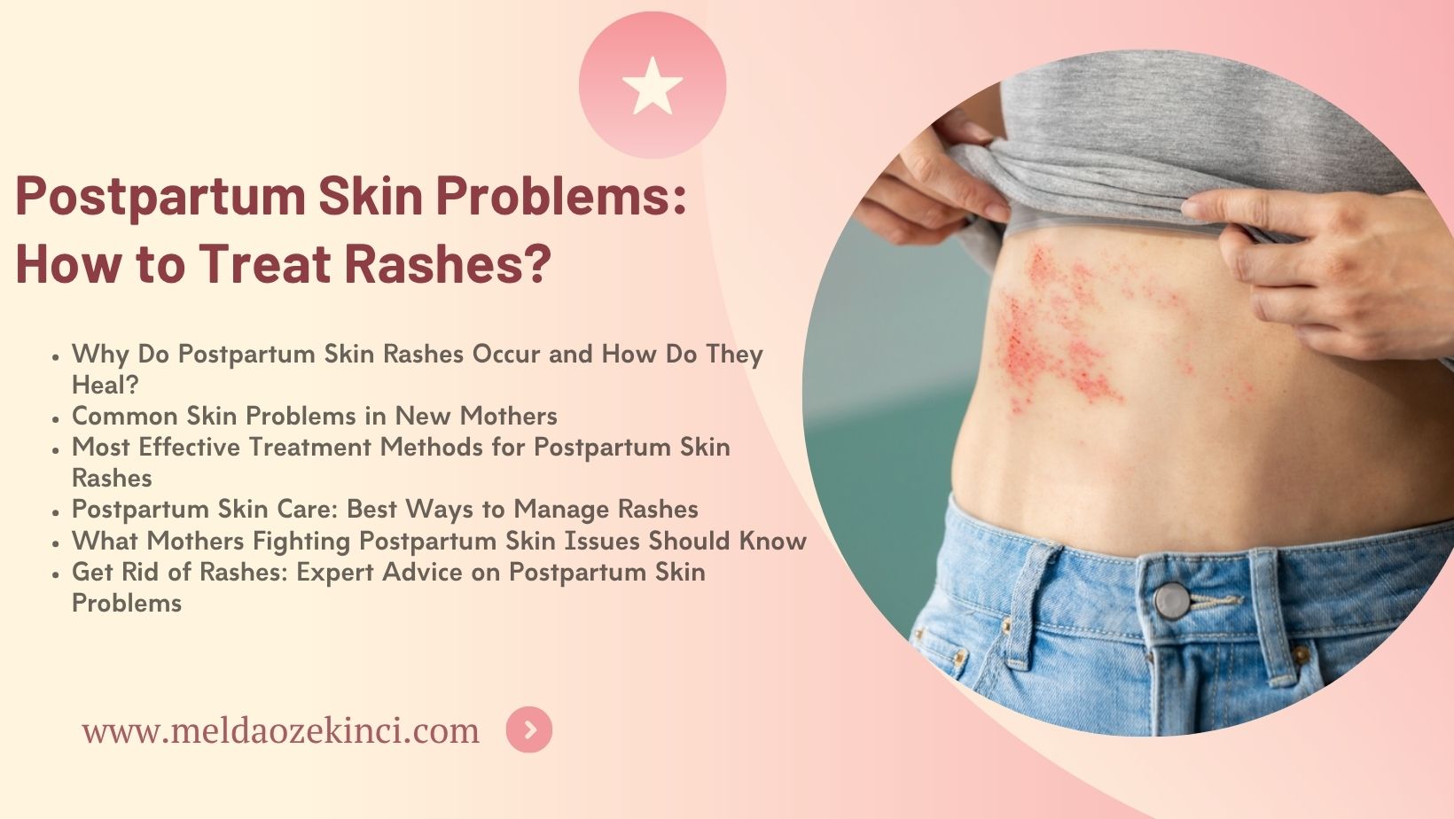 Postpartum Skin Problems: How to Treat Rashes?