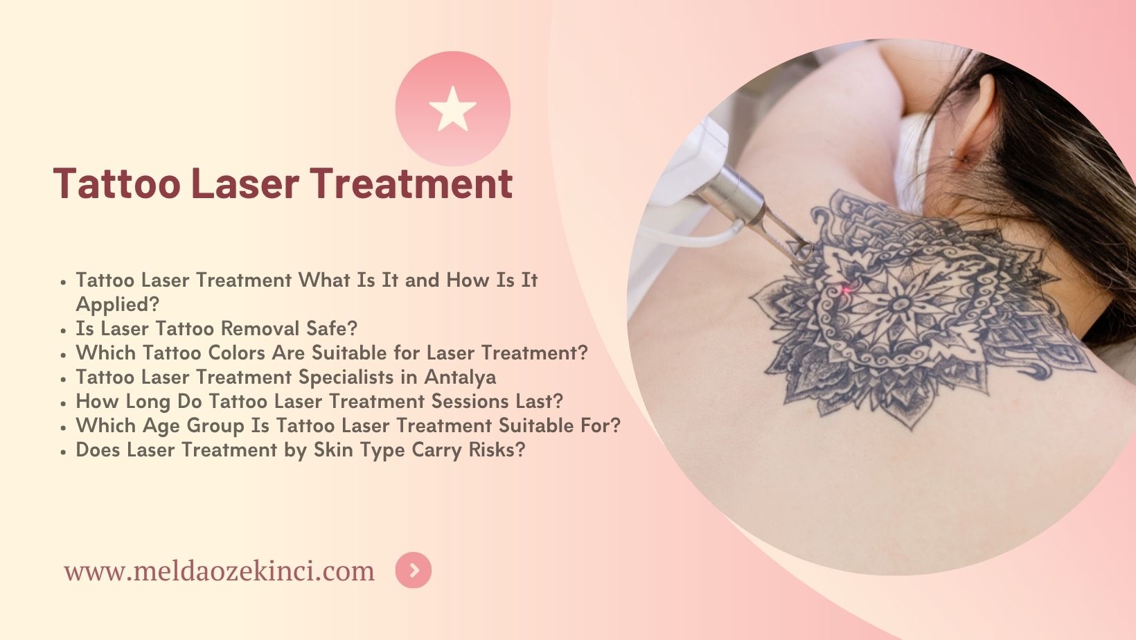Tattoo Laser Treatment