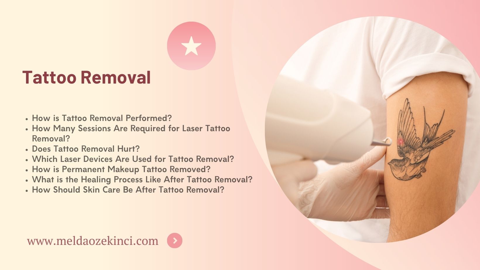 Tattoo Removal