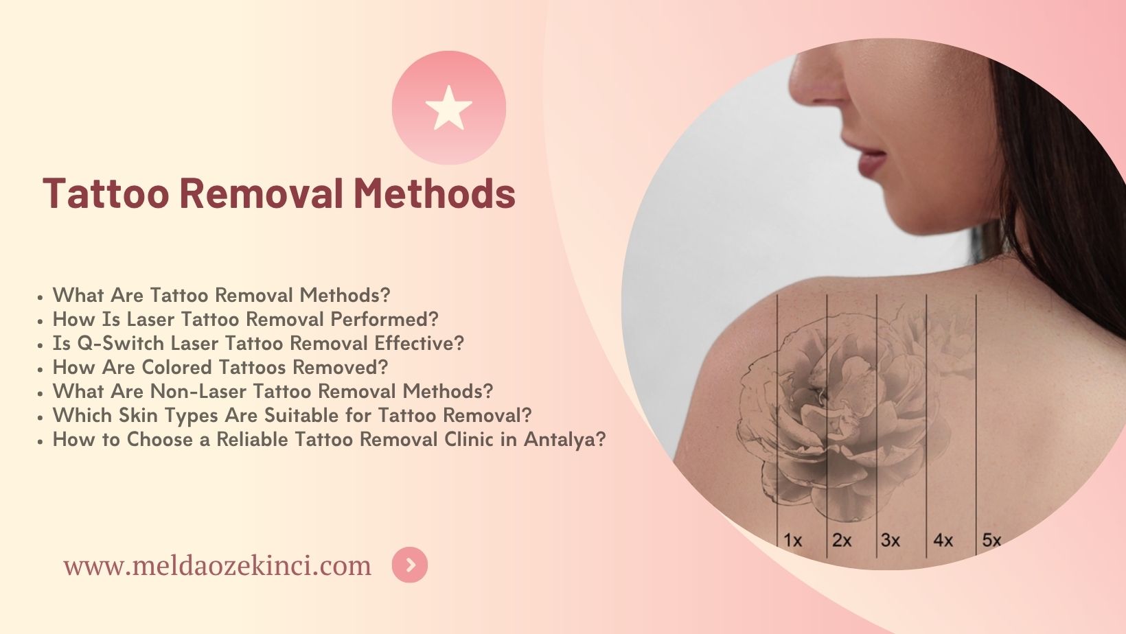 Tattoo Removal Methods