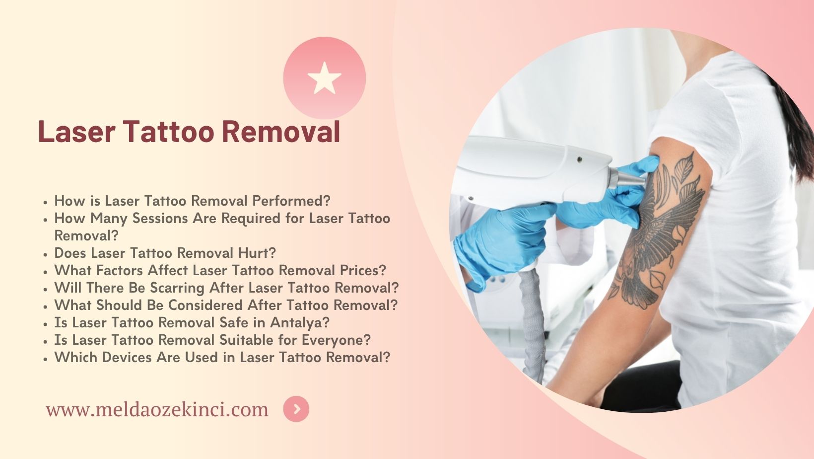 Laser Tattoo Removal 