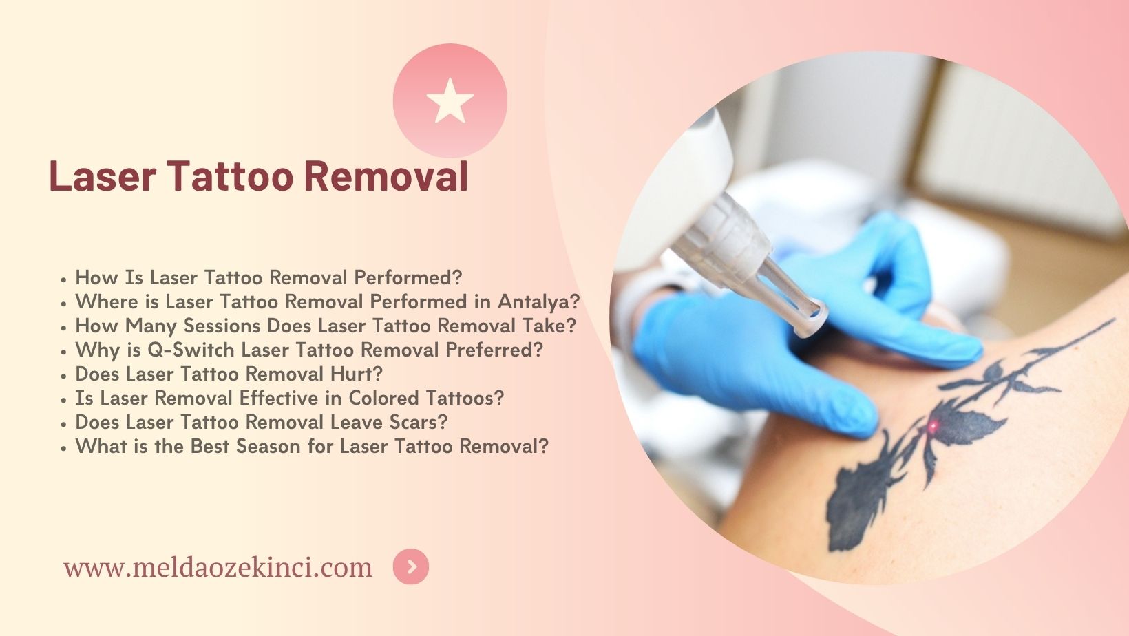 Laser Tattoo Removal