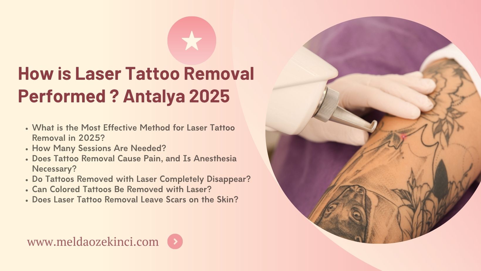 How is Laser Tattoo Removal Performed ? Antalya 2025 