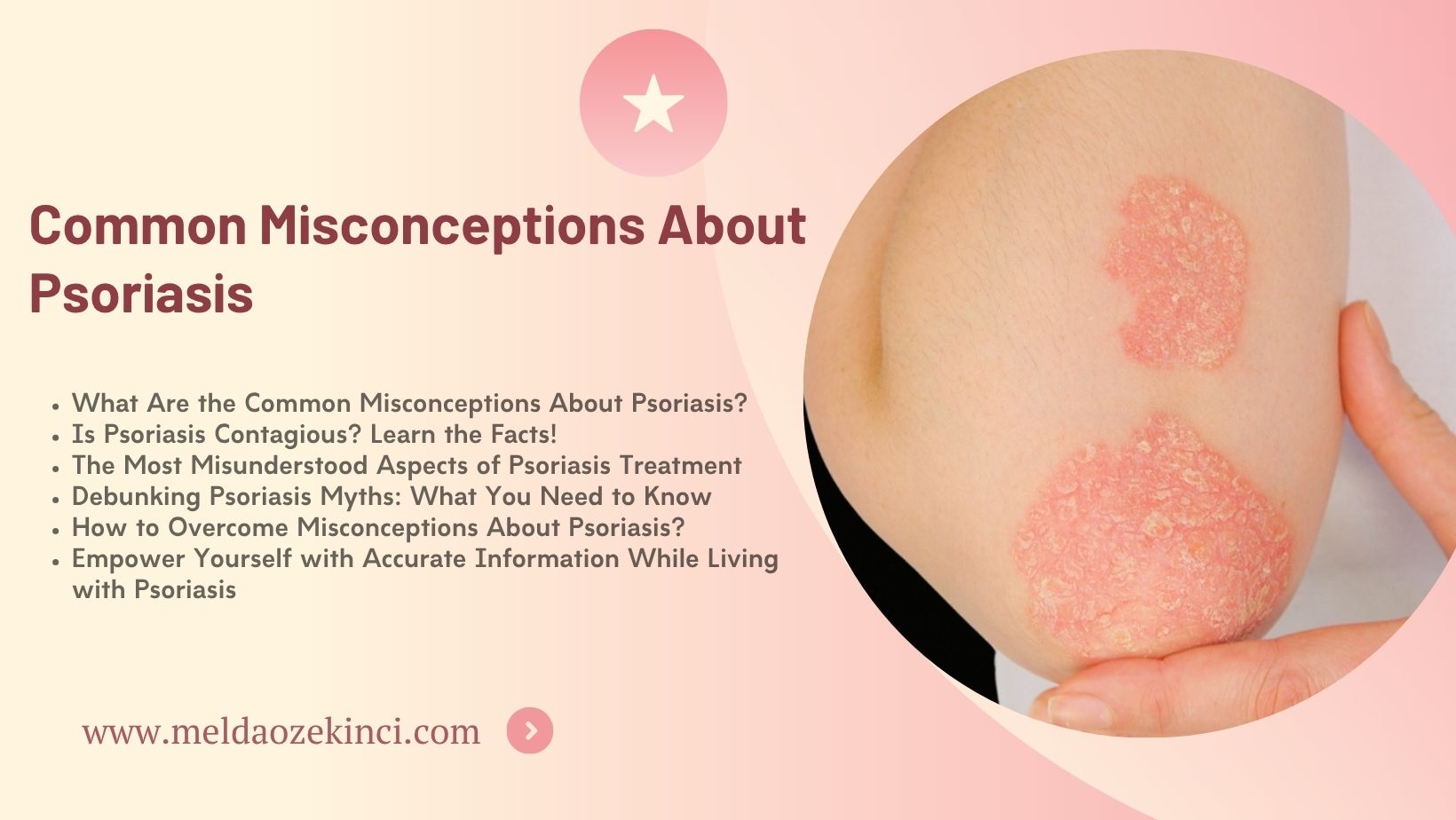 Common Misconceptions About Psoriasis