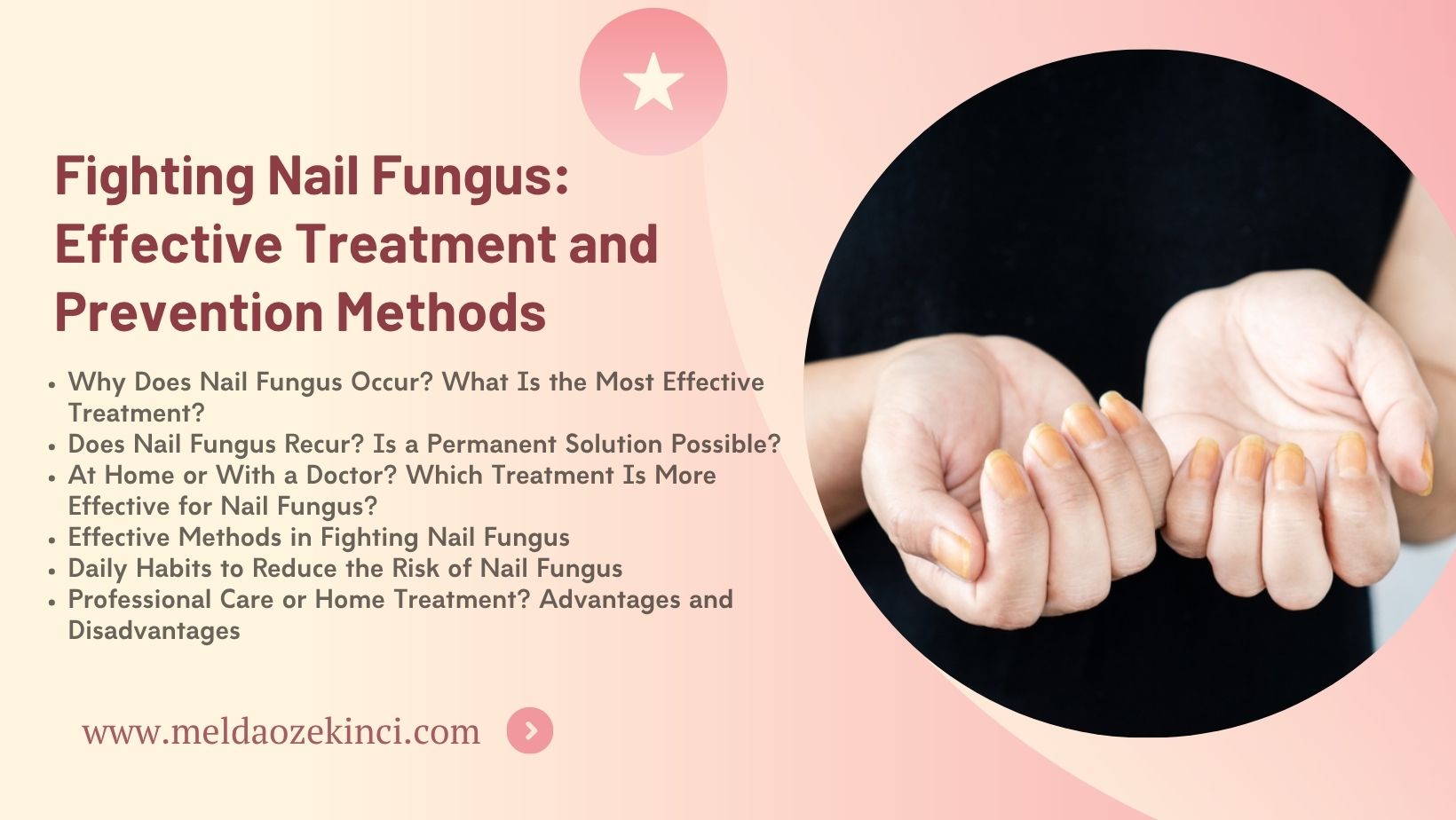 Fighting Nail Fungus: Effective Treatment and Prevention Methods
