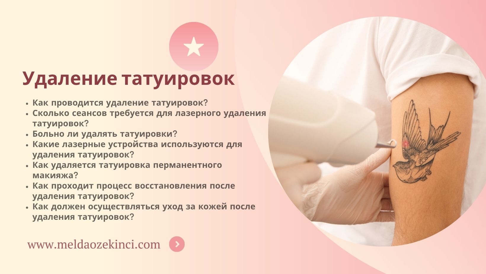 Удаление татуировок