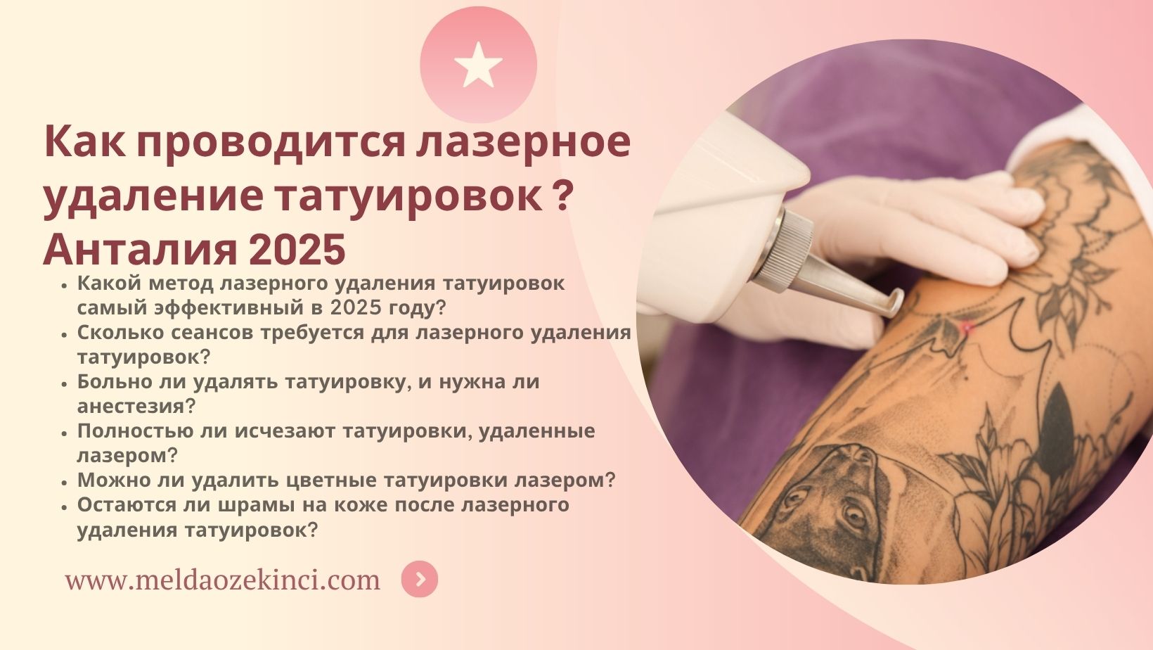 Как проводится лазерное удаление татуировок ? Анталия 2025 