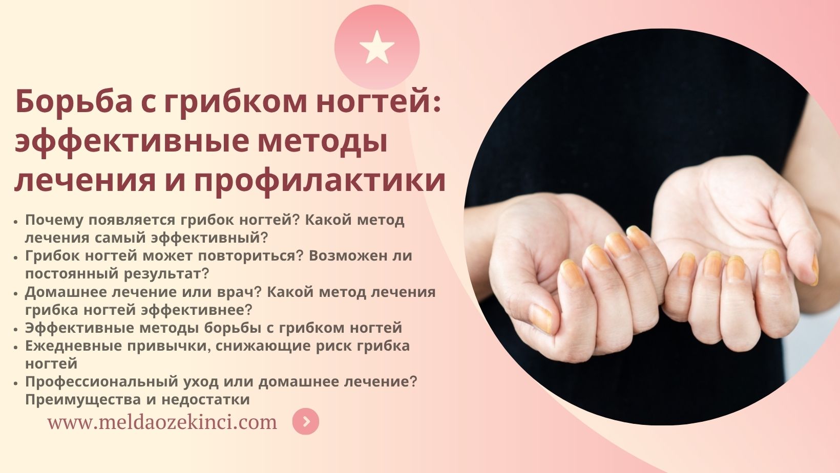 Борьба с грибком ногтей: эффективные методы лечения и профилактики