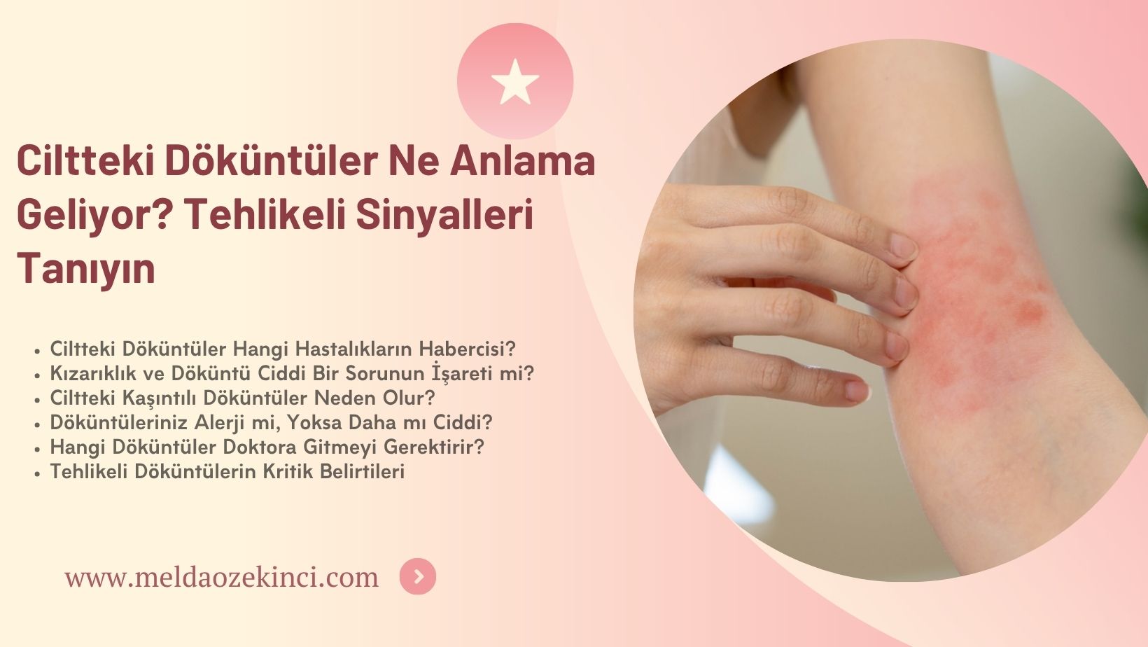 Ciltteki Döküntüler Ne Anlama Geliyor? Tehlikeli Sinyalleri Tanıyın