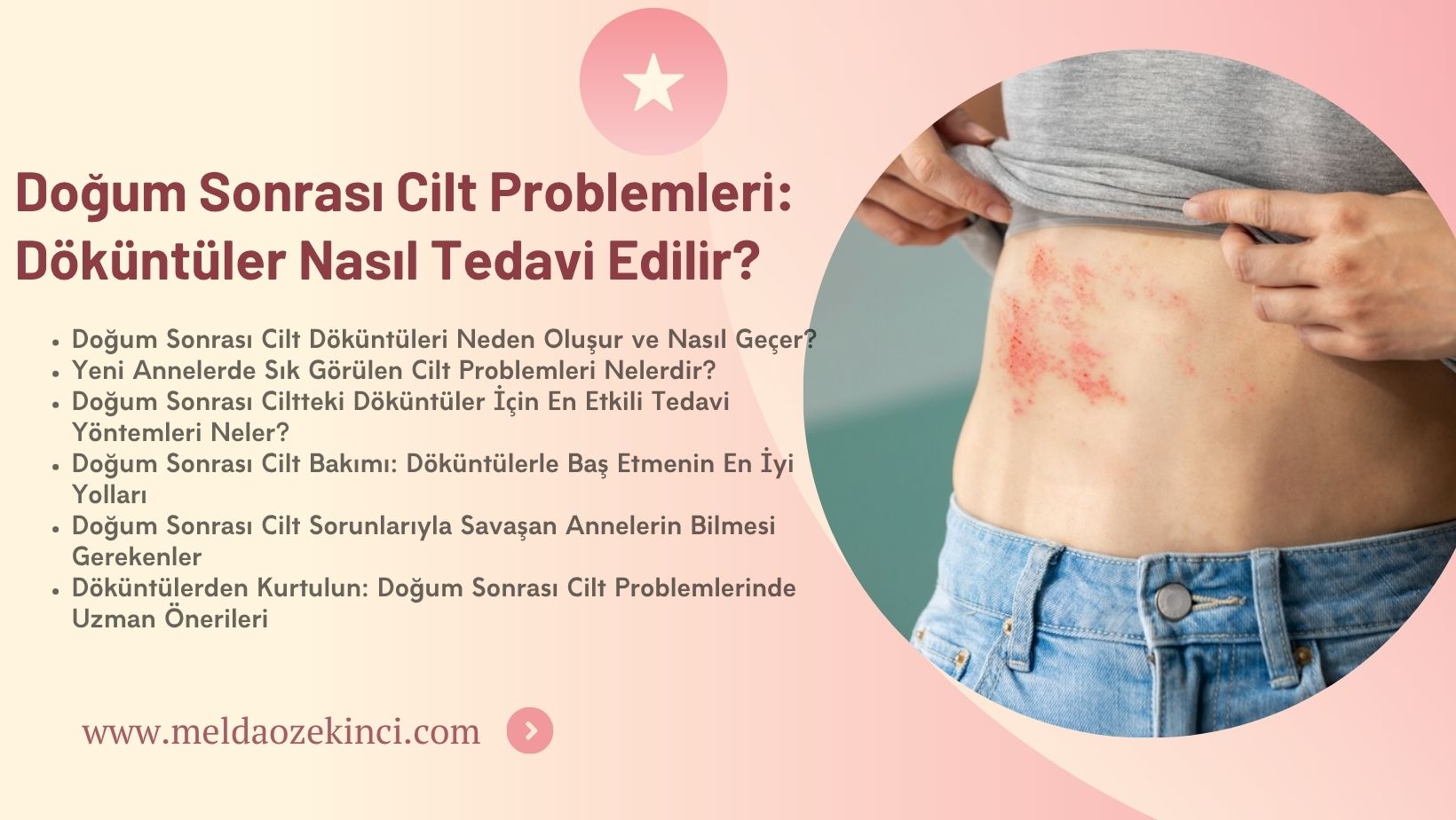 Doğum Sonrası Cilt Problemleri: Döküntüler Nasıl Tedavi Edilir?