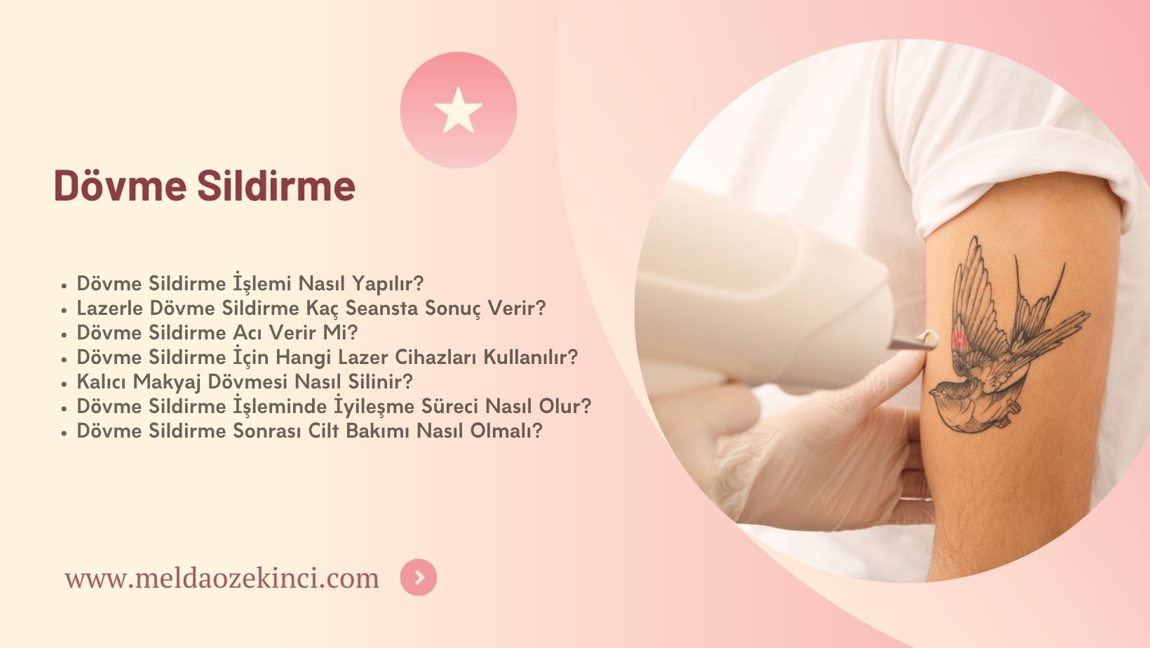 Dövme Sildirme
