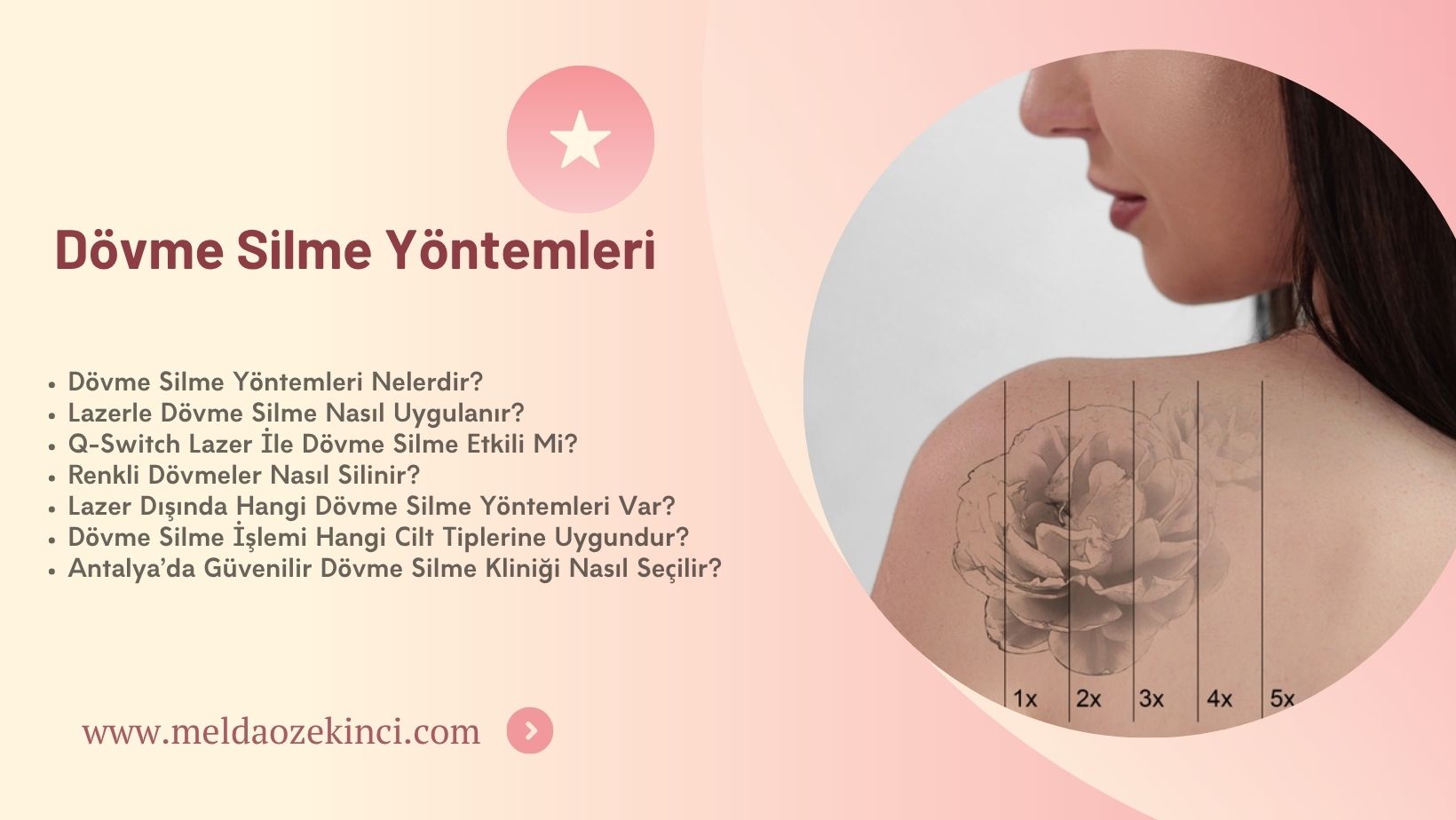 Dövme Silme Yöntemleri