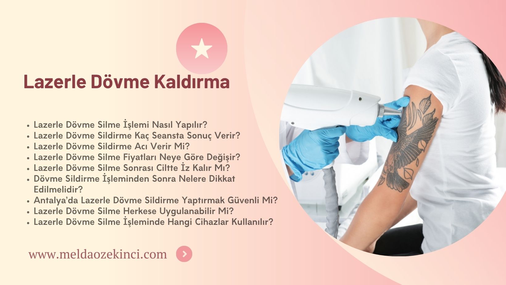 Lazerle Dövme Kaldırma