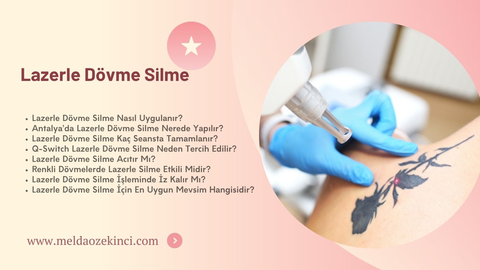 Lazerle Dövme Silme