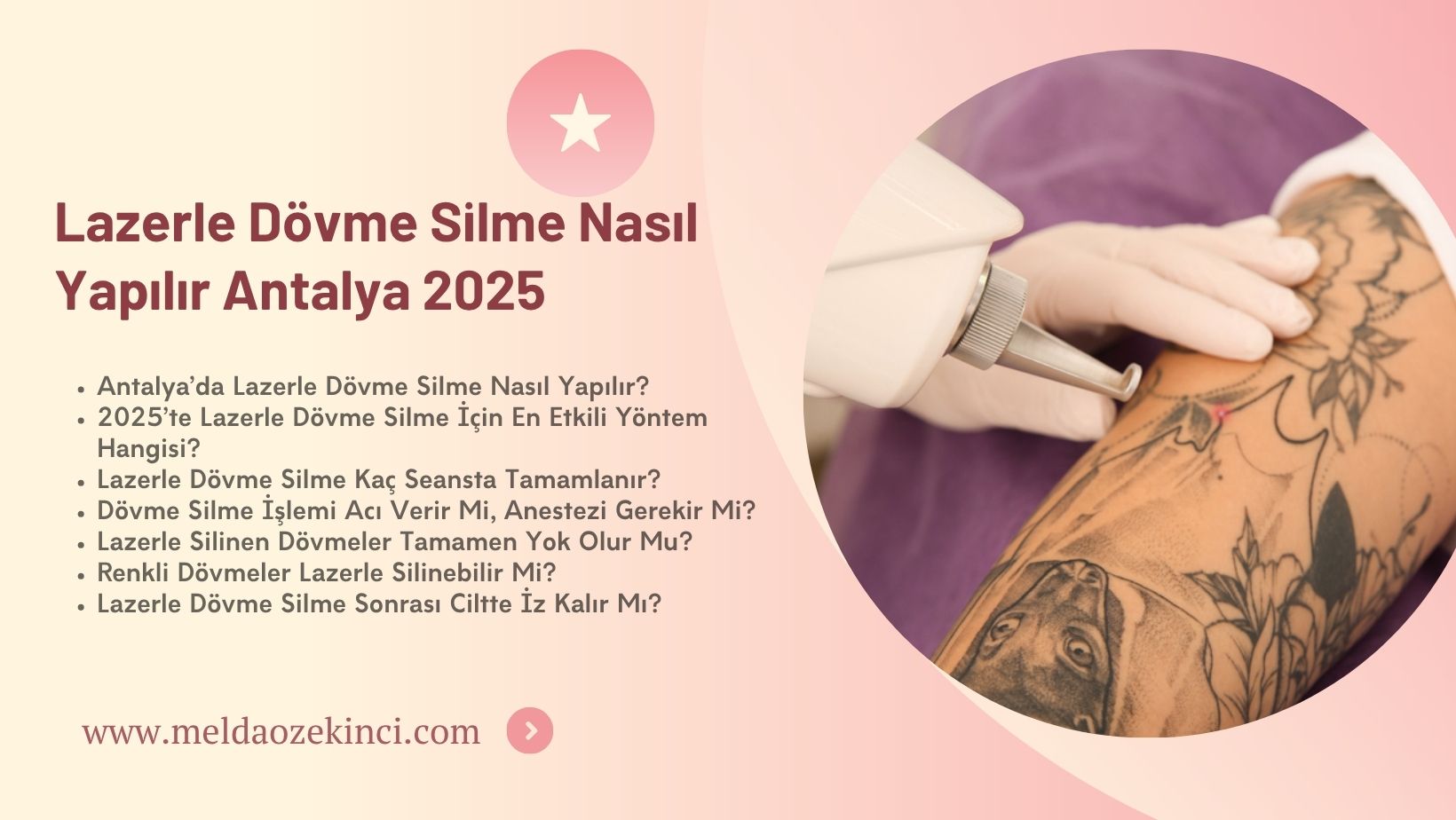 Lazerle Dövme Silme Nasıl Yapılır ? Antalya 2025 
