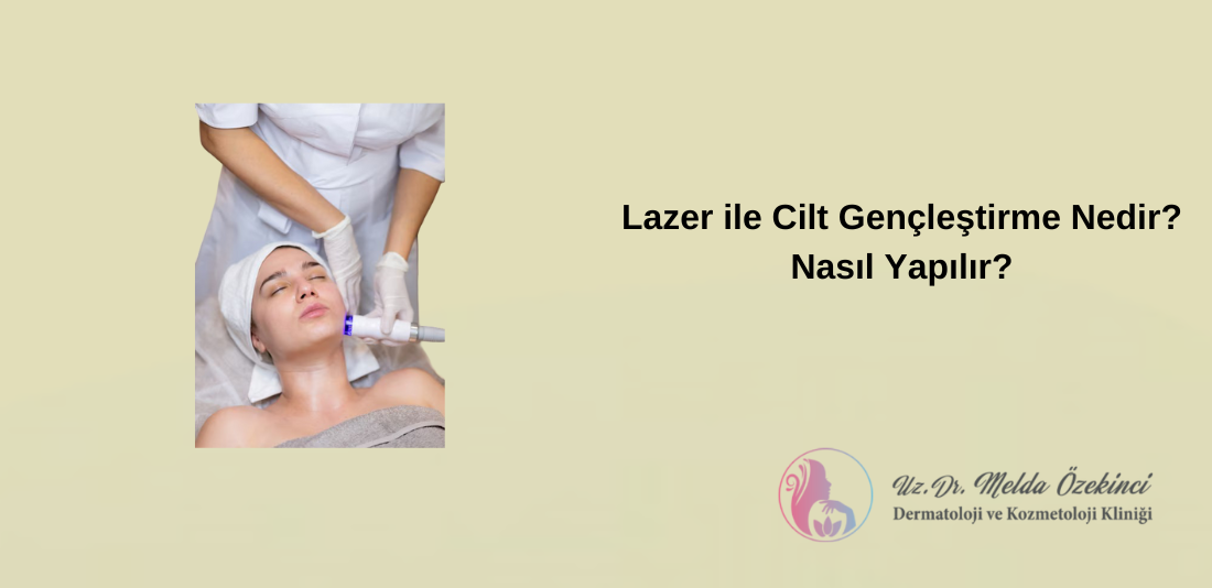 Lazerle Cilt Gençleştirme