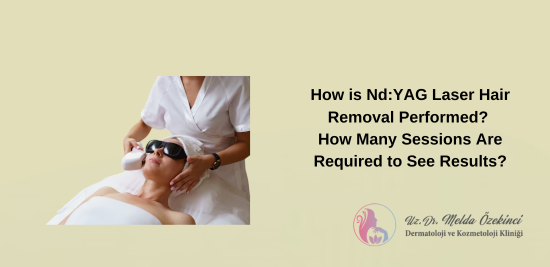 Nd:YAG Laser