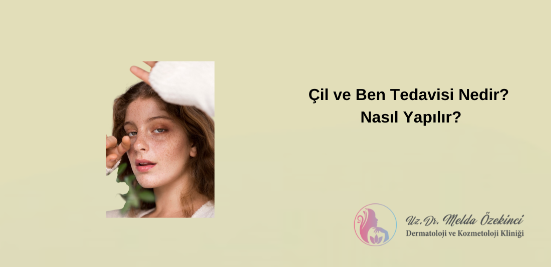 Çil ve Ben Tedavisi