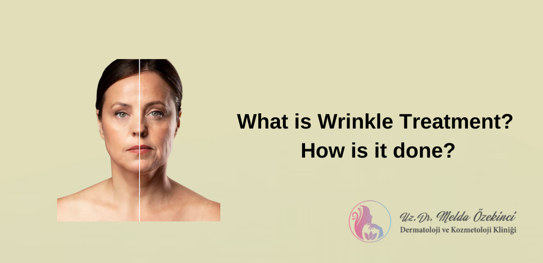 Wrinkle treatment Wrinkle treatment