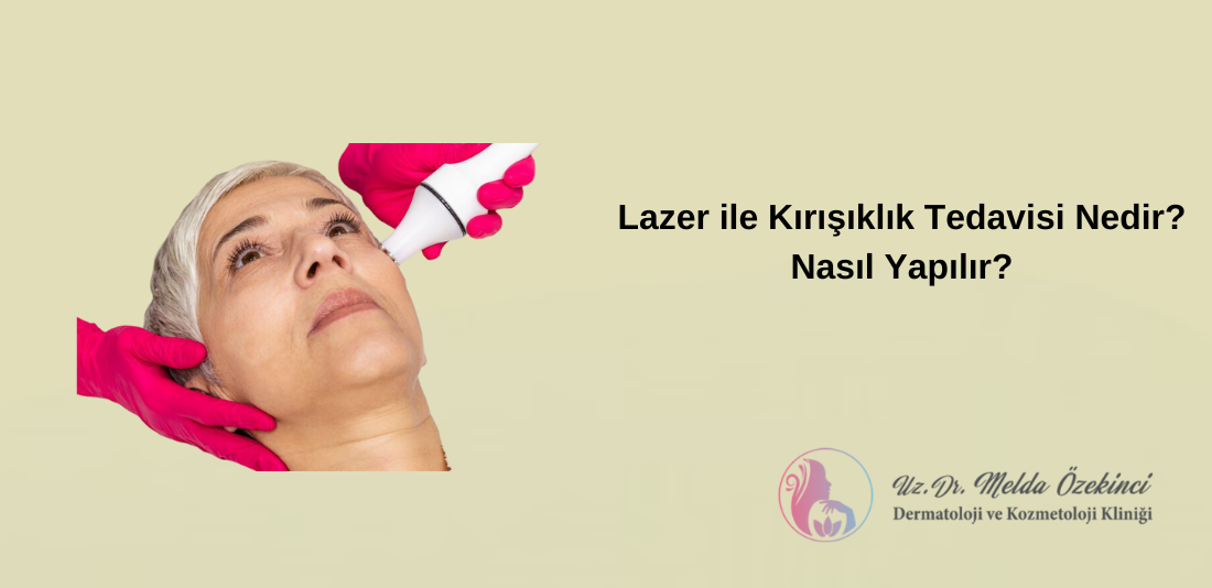 Lazerle Kırışıklık Tedavisi