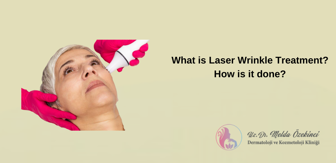 Laser Wrinkle Treatment