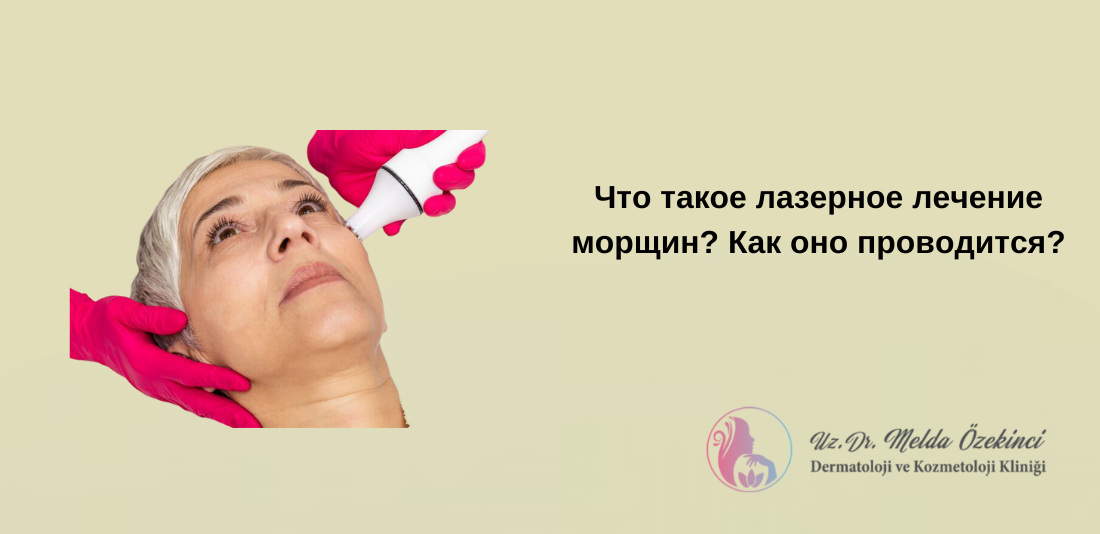 Лазерное лечение морщин