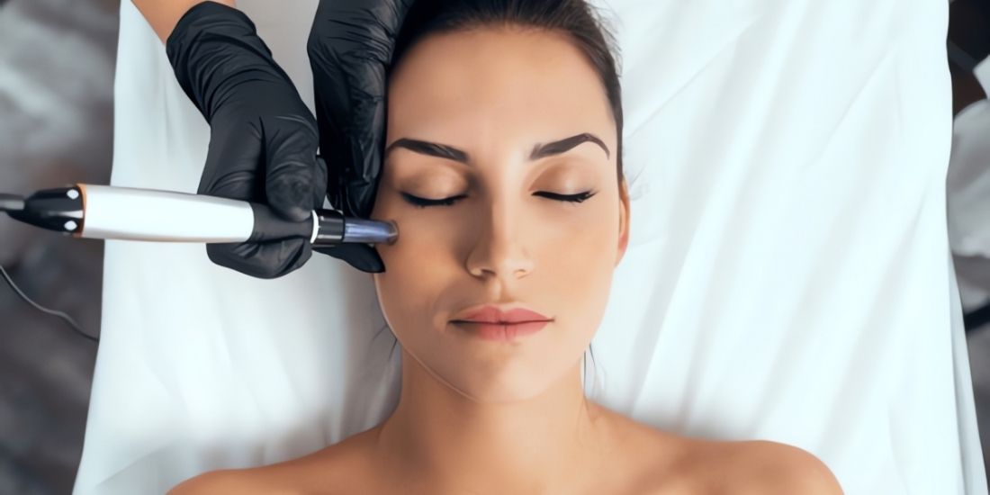 Smoother and More Radiant Skin with Dermapen Treatment