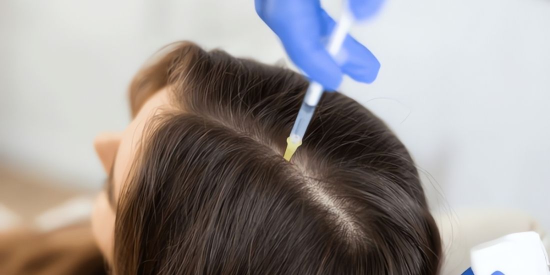 Effective Solutions for Hair Loss with PRP Effective Solutions for Hair Loss with PRP