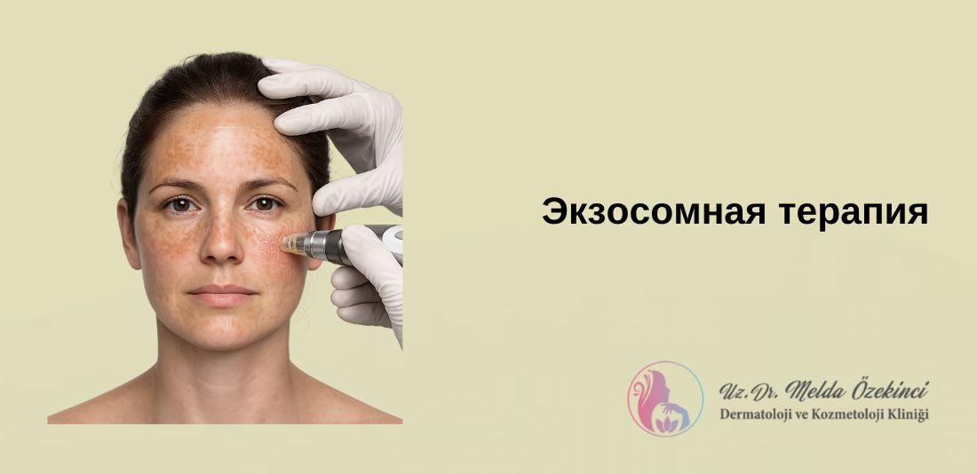 Что такое экзосомальная терапия? Для кого это подходит? Что такое экзосомальная терапия? Для кого это подходит?