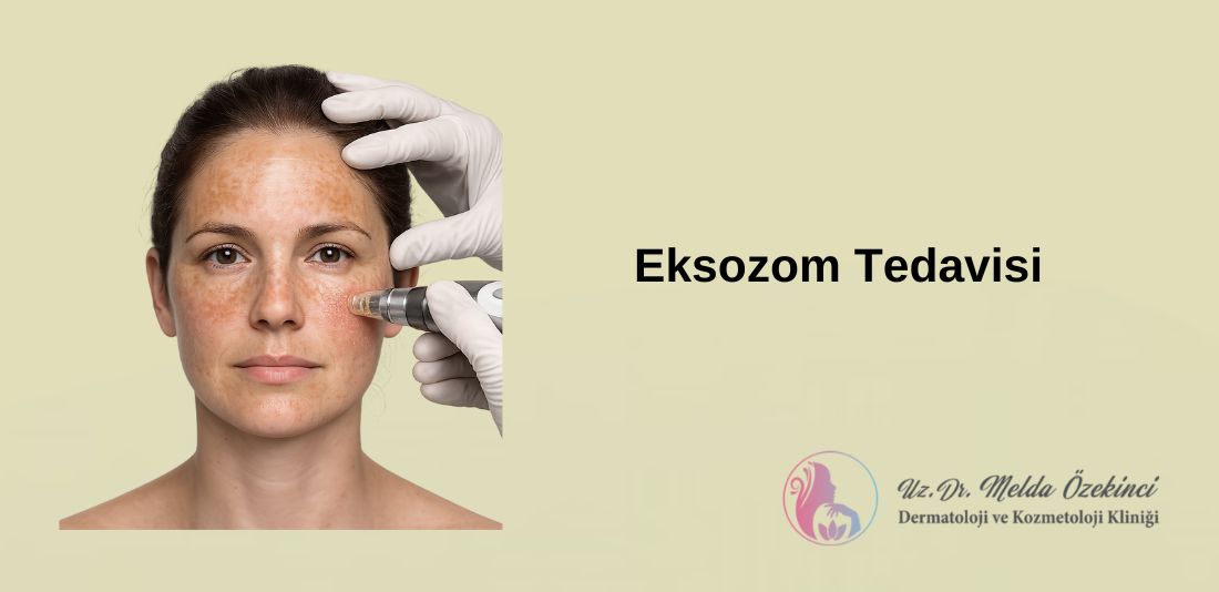 Eksozom Tedavisi Nedir? Kimler İçin Uygundur?