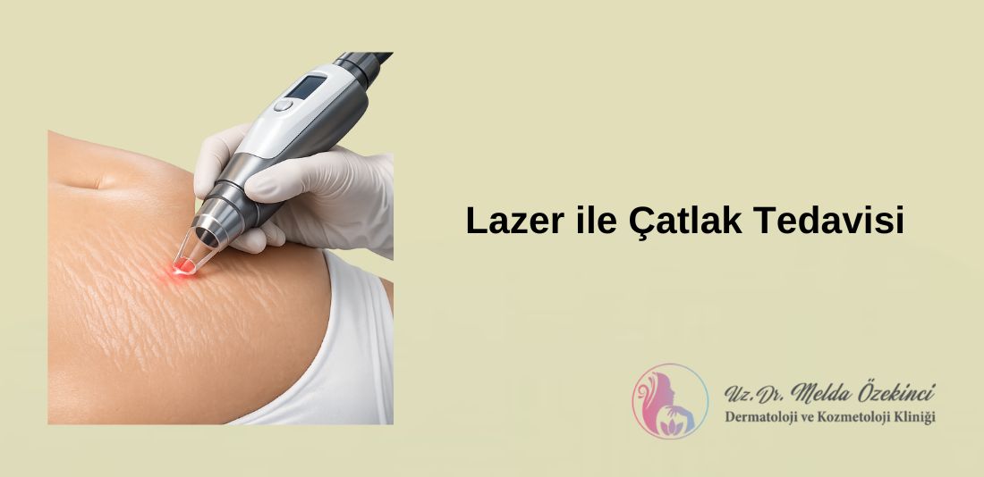 Lazer ile Çatlak Tedavisi Nasıl Yapılır