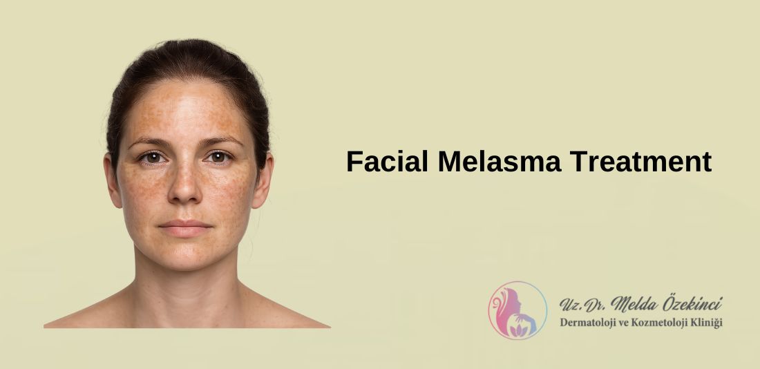 Treatment Methods for Melasma Spots on the Face