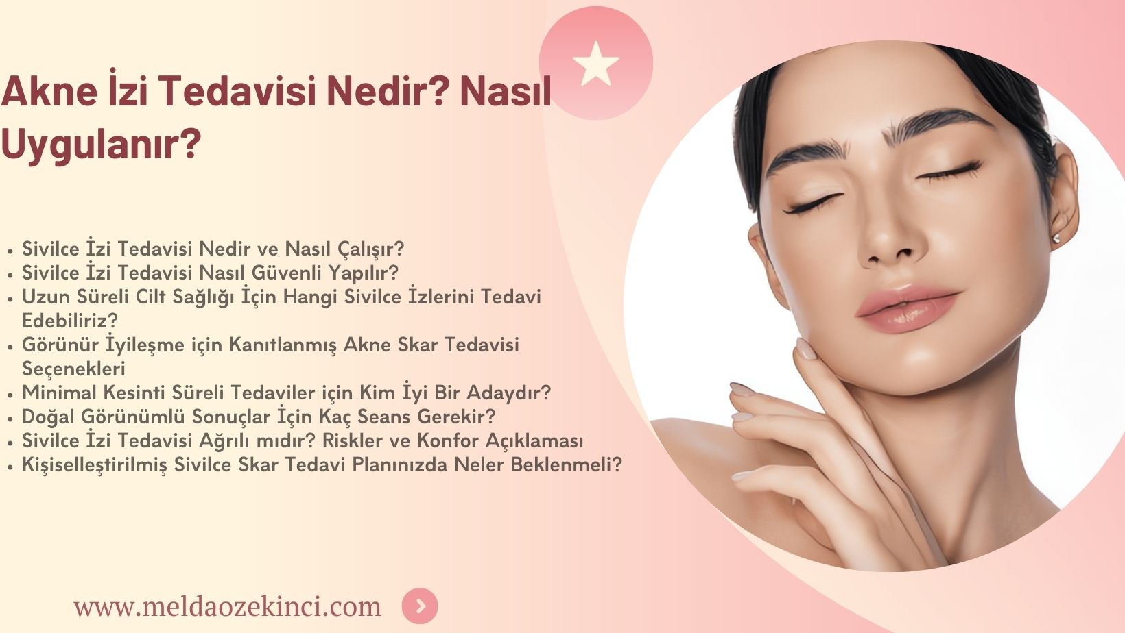 Akne İzi Tedavisi Nedir? Nasıl Uygulanır? 