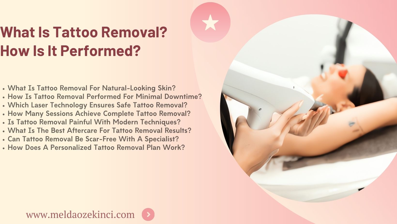 What Is Tattoo Removal? How Is It Performed?