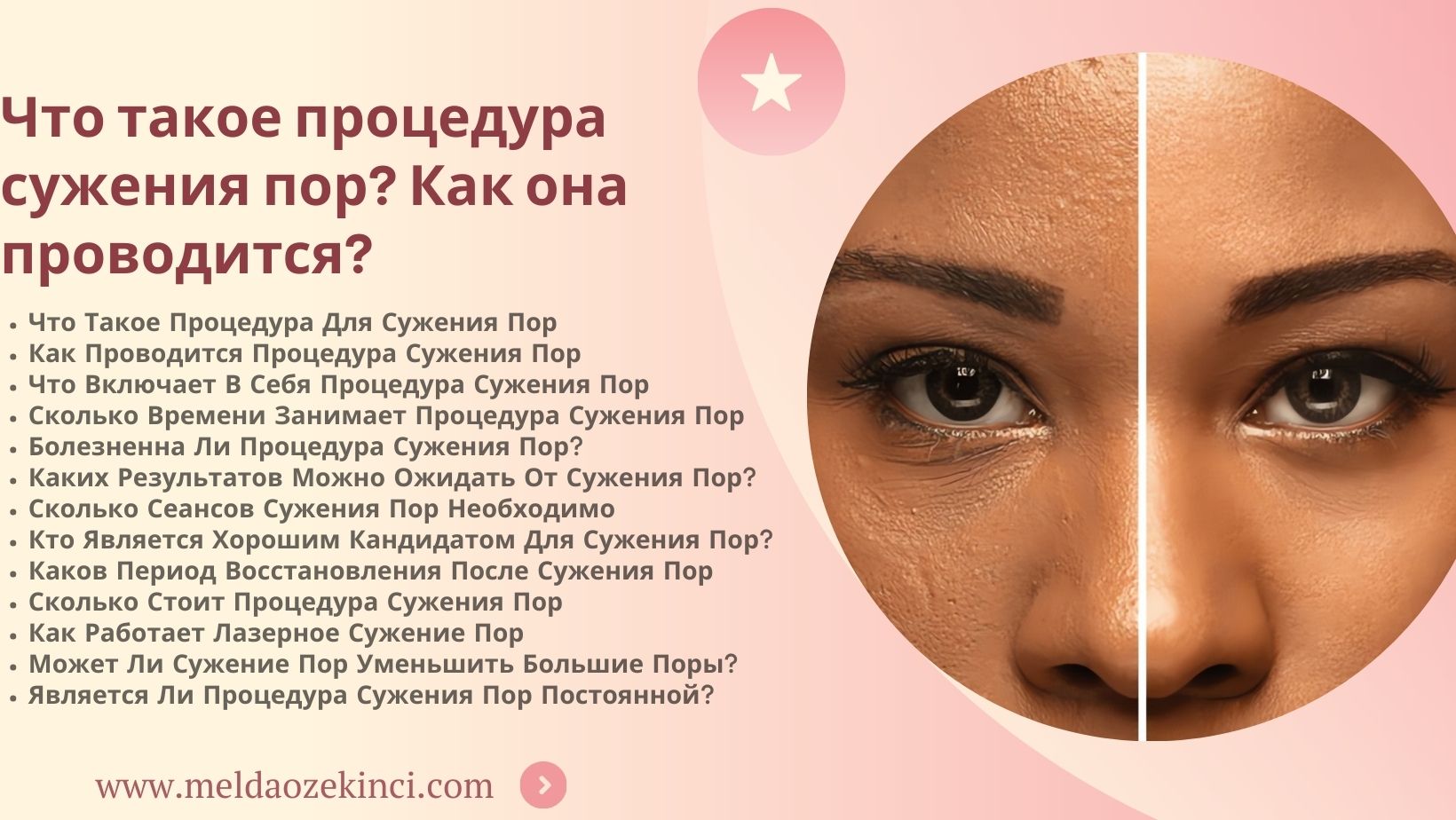 Что такое процедура сужения пор? Как это выполняется?