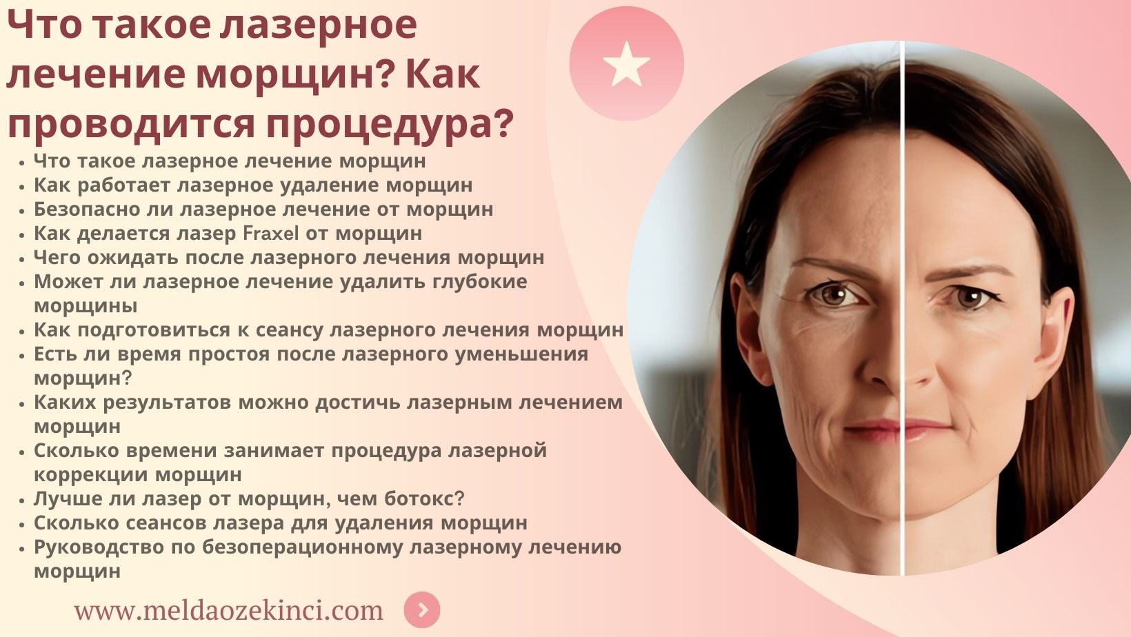 Что такое лазерное лечение морщин? Как это делается?