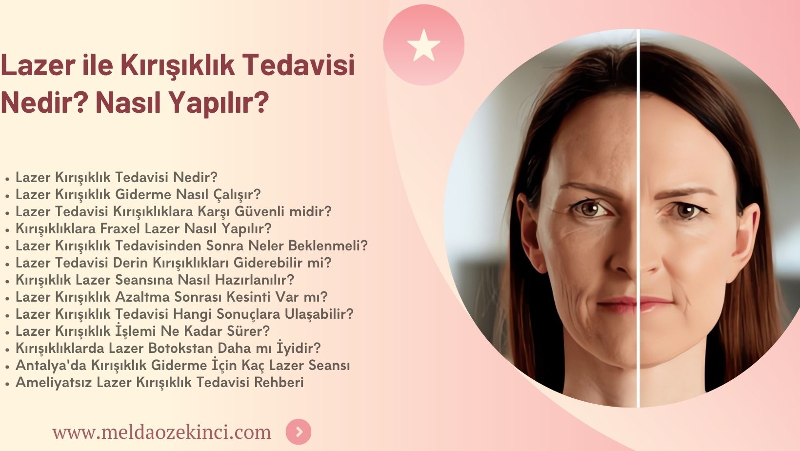 Lazer Kırışıklık Tedavisi Nedir? Nasıl Yapılır?