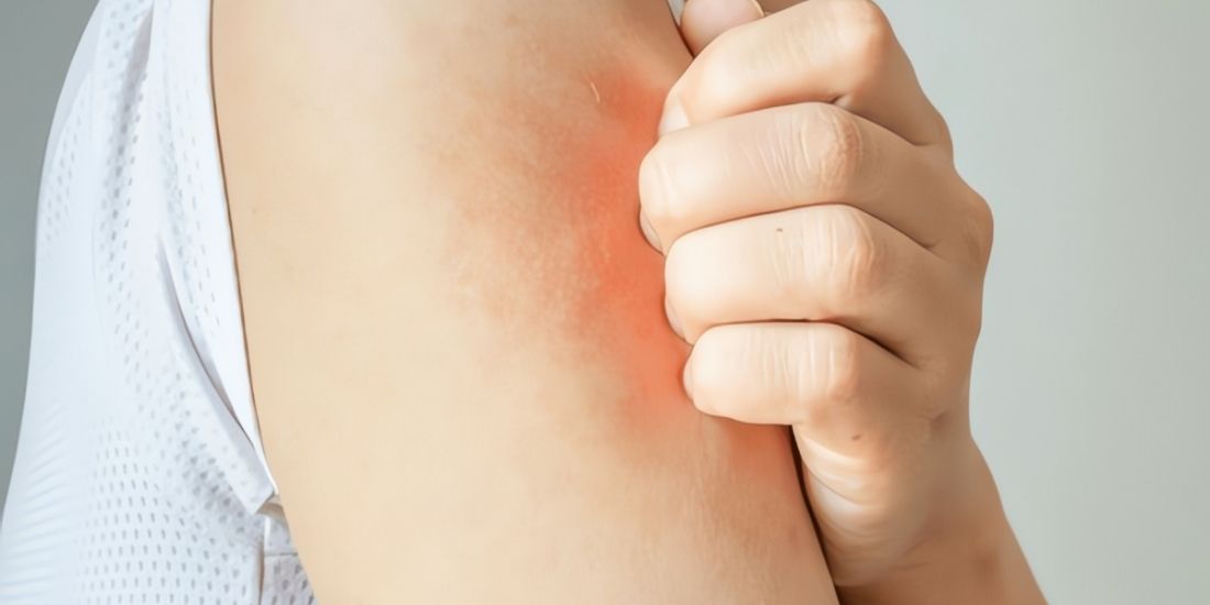 Dermatologist Treatment for Skin Itching Dermatologist Treatment for Skin Itching