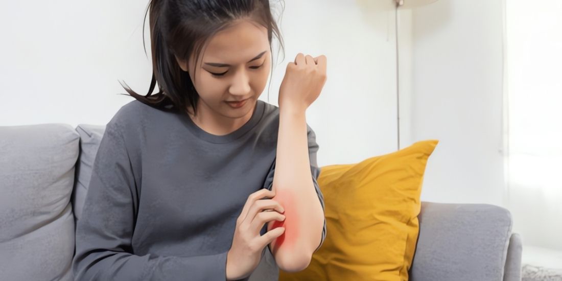 How is a Dermatological Allergy Test Performed? How is a Dermatological Allergy Test Performed?