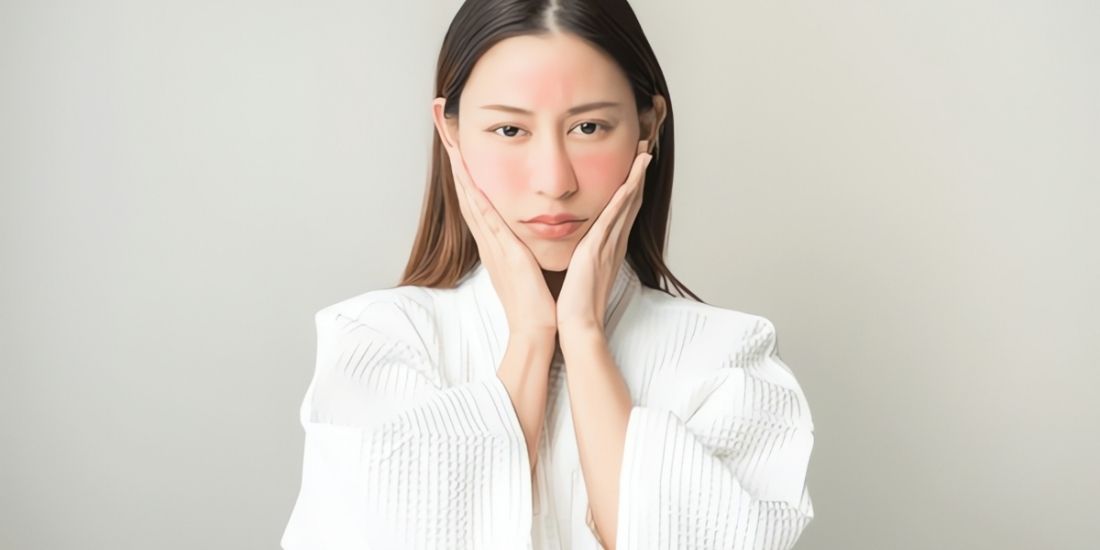 How is Rosacea (Rose Disease) Treated?