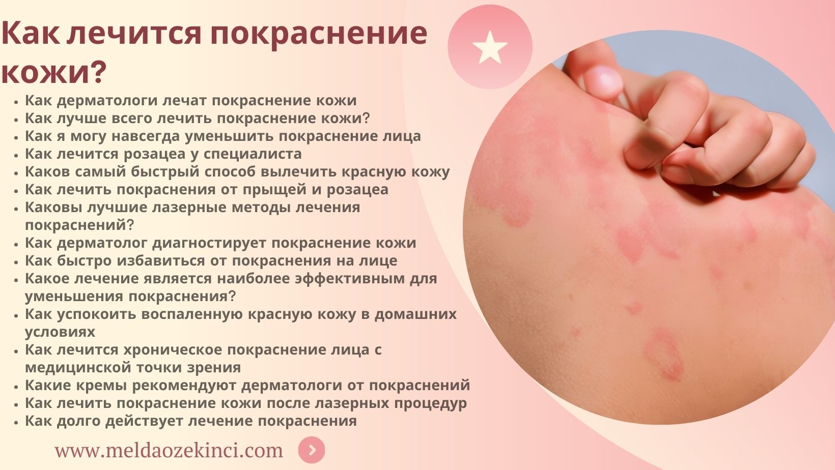 How is Skin Redness Treated?