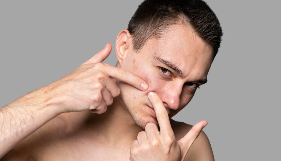 Antalya Acne Scar Treatment Prices