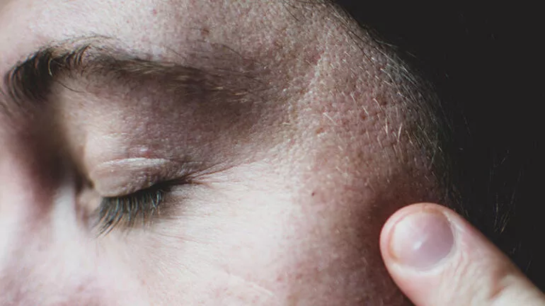 Yüz Kırışıklığı Yüz Kırışıklığı